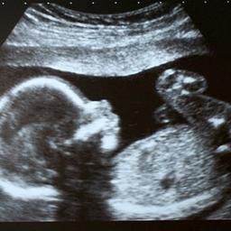 Baby Maju